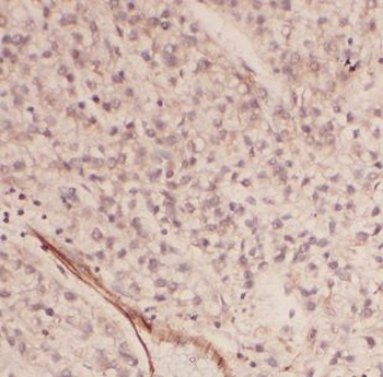 AUP1 Rabbit Polyclonal Antibody