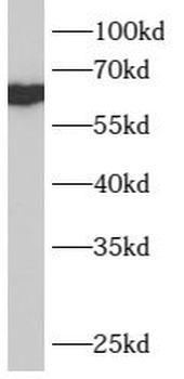 B4GALNT1 Rabbit Polyclonal Antibody