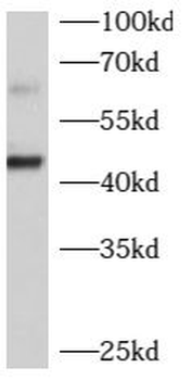 B4GALT2 Rabbit Polyclonal Antibody