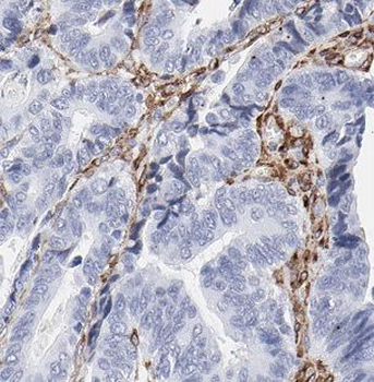 B4GALT2 Rabbit Polyclonal Antibody
