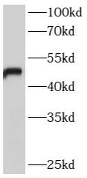 B4GALT6 Rabbit Polyclonal Antibody