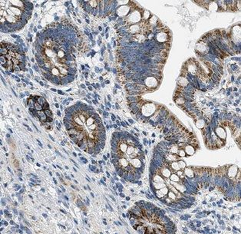 B4GALT6 Rabbit Polyclonal Antibody