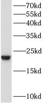 BAALC Rabbit Polyclonal Antibody