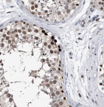 BAALC Rabbit Polyclonal Antibody
