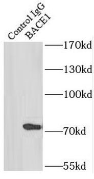 BACE1 Antibody