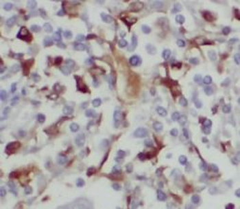 BAGE4 Rabbit Polyclonal Antibody