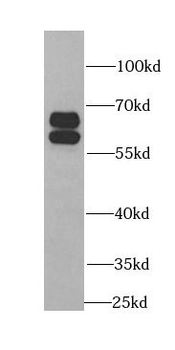 BAIAP2 Antibody
