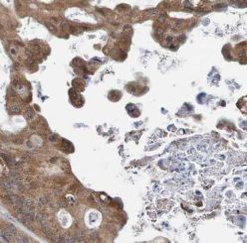 BAIAP2L1 Rabbit Polyclonal Antibody