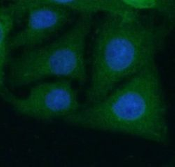 BAIAP3 Rabbit Polyclonal Antibody