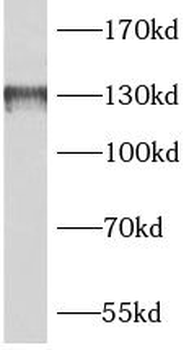 BAIAP3 Rabbit Polyclonal Antibody