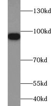 SLC4A1 Antibody