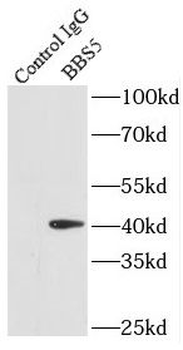 BBS5 Rabbit Polyclonal Antibody
