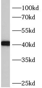 BBS5 Rabbit Polyclonal Antibody