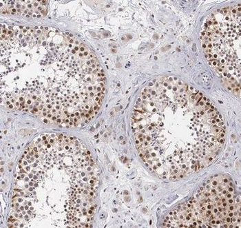 BBS5 Rabbit Polyclonal Antibody