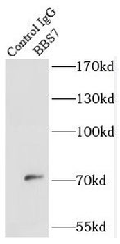 BBS7 Rabbit Polyclonal Antibody