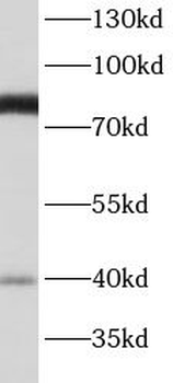 BBS7 Rabbit Polyclonal Antibody