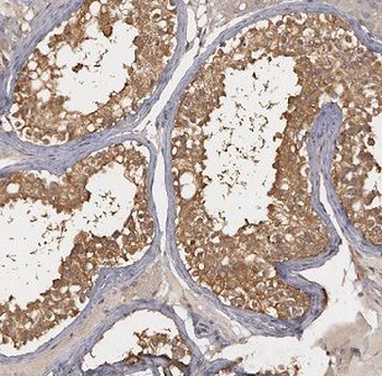 BBS7 Rabbit Polyclonal Antibody