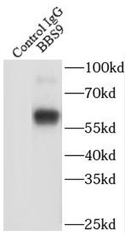 BBS9 Antibody
