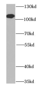 BCAS3 Rabbit Polyclonal Antibody