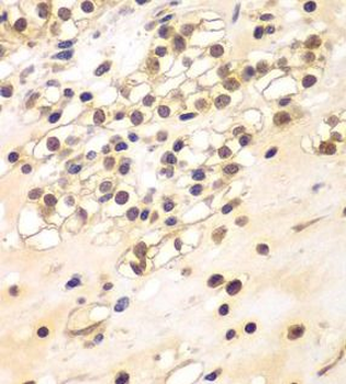 BCAS3 Rabbit Polyclonal Antibody
