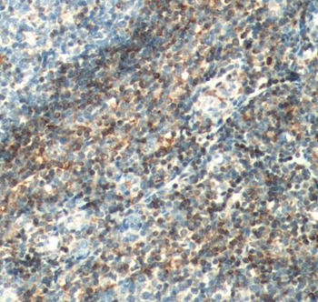 BCL2 Antibody