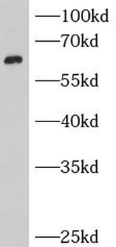 BCO1 Rabbit Polyclonal Antibody