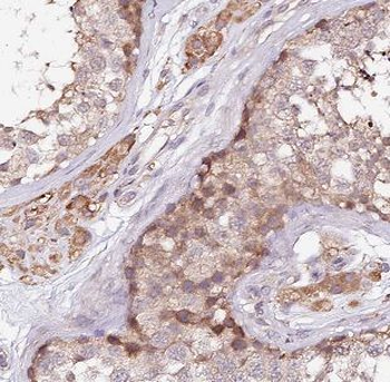 BCO1 Rabbit Polyclonal Antibody