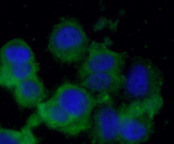 BDNF Rabbit Polyclonal Antibody