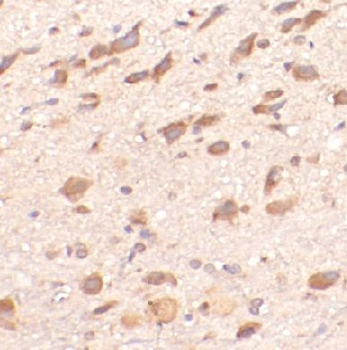 BDNF Rabbit Polyclonal Antibody