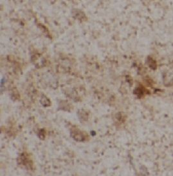 BDNF Rabbit Polyclonal Antibody