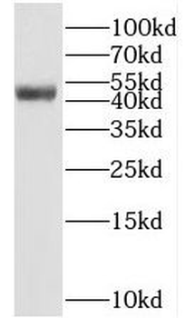 BEND5 Rabbit Polyclonal Antibody