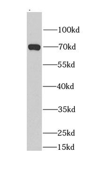 BEST1 Rabbit Polyclonal Antibody