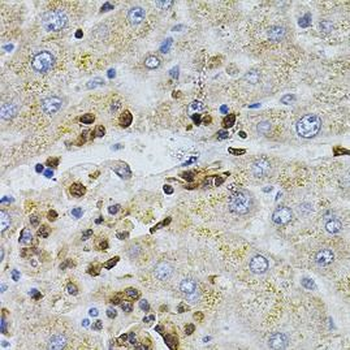 BEST1 Rabbit Polyclonal Antibody