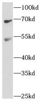 BEST1 Rabbit Polyclonal Antibody