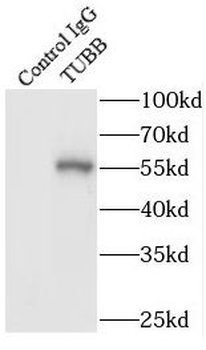 Beta Tubulin Antibody