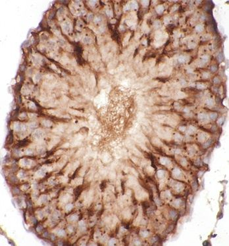 Beta Tubulin Antibody