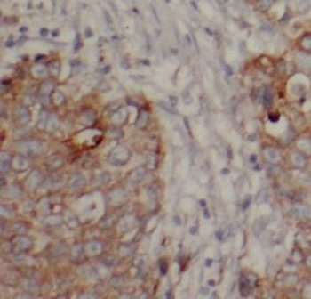 CTNNB1 Rabbit Polyclonal Antibody