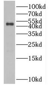 BFSP2 Rabbit Polyclonal Antibody