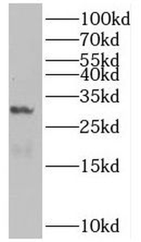 BHLHA15 Rabbit Polyclonal Antibody