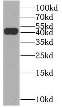 BHMT2 Rabbit Polyclonal Antibody