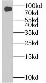 BIN2 Rabbit Polyclonal Antibody