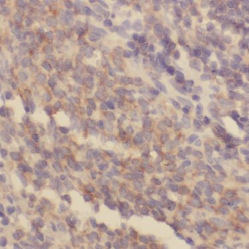 BIN2 Rabbit Polyclonal Antibody