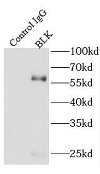 BLK Rabbit Polyclonal Antibody