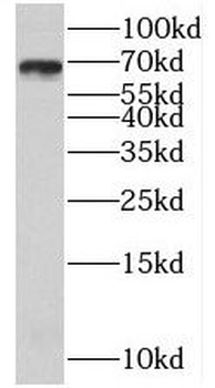 BLNK Antibody