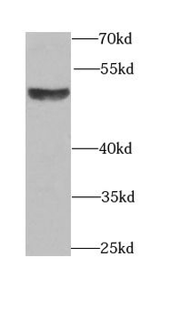 BMP15 Antibody