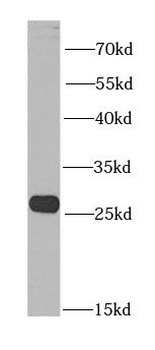 BNIP1 Rabbit Polyclonal Antibody