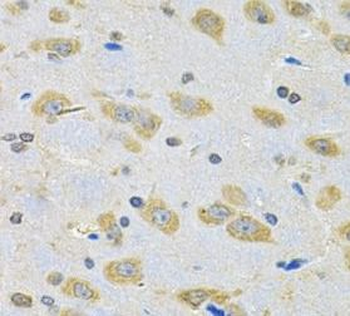 BNIP1 Rabbit Polyclonal Antibody