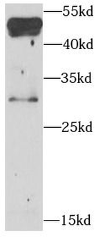 BNIP3L Antibody