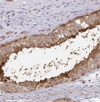 BOLL Rabbit Polyclonal Antibody