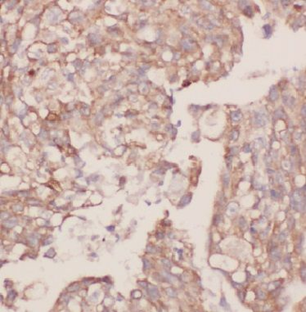 BPIFB2 Rabbit Polyclonal Antibody
